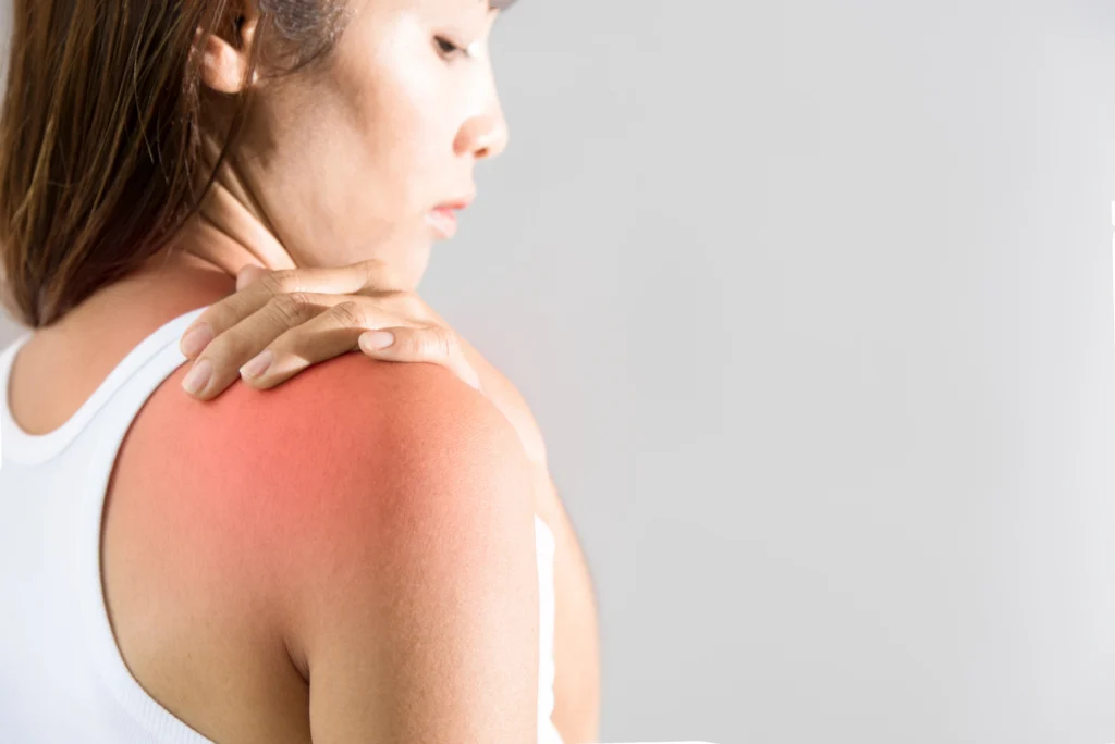 patient with shoulder pain considering shoulder impingement surgery.
